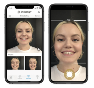 my invisalign app