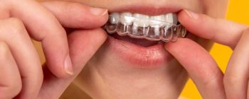 invisalign first opiniones