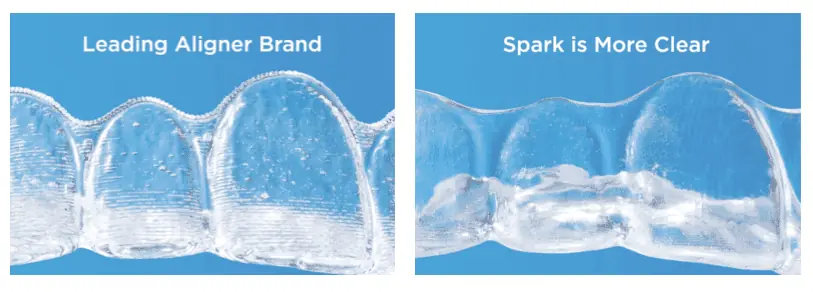 Spark vs Invisalign