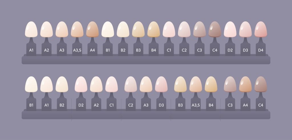 Escala de colores de dientes: color de dientes a1 o b1.