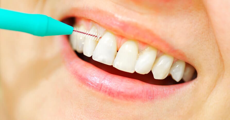 interdental tooth brushing