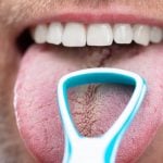 34059Cómo blanquear los dientes al instante: las formas más rápidas de blanquear los dientes