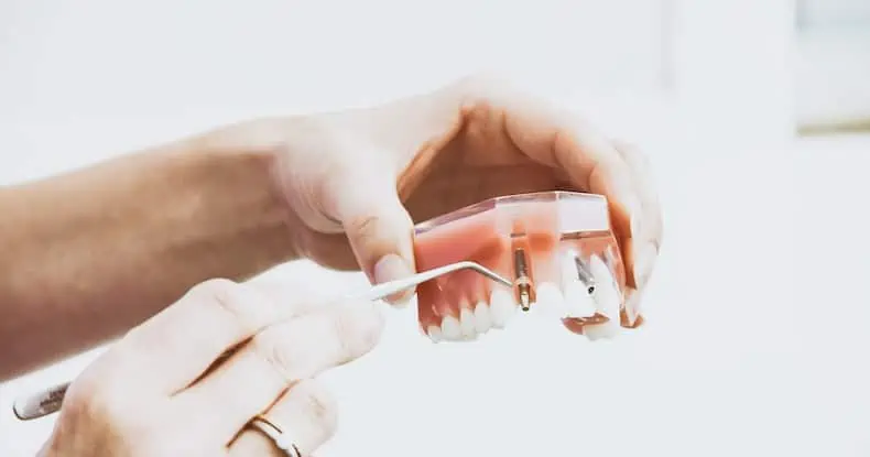 dental implant showing through gum