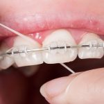 34123Causas de la xerostomía: por qué se seca la boca y mejores tratamientos
