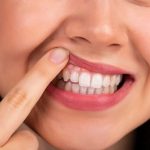 52443Blanqueamiento dientes sensibles: Kits y tiras para dientes sensibles