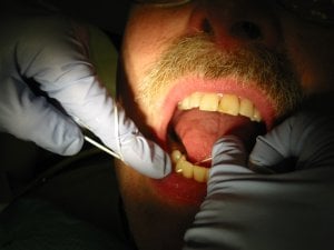 dentist flossing patient's teeth