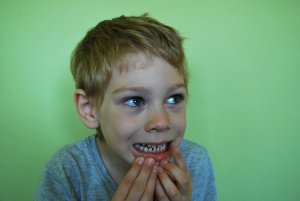 Children with bruxism