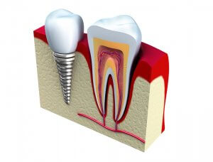 dental monthly payments