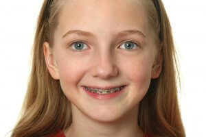 Dental care for children with braces