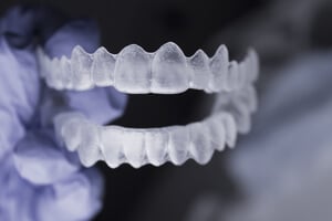 braces inside mouth