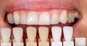 how to whiten fake teeth