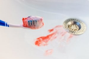 gums bleeding when brushing teeth