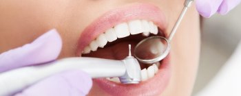 woman getting dental filling