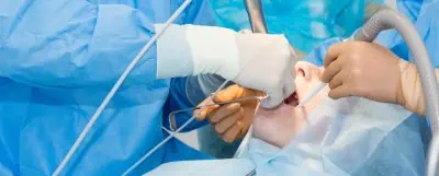 Sinus lift surgery