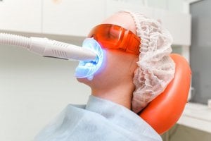 laser teeth whitening cost