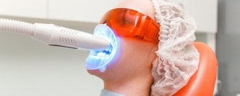 teeth whitening at the dentist