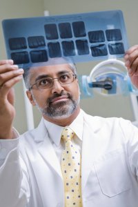 dental implants India