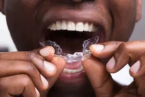 forsikring, der dækker invisalign