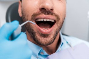 man at the dentist