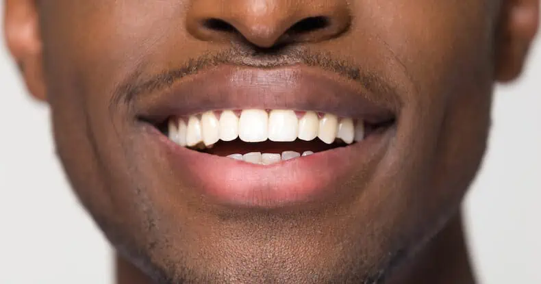 temporary teeth save your smile from gaps