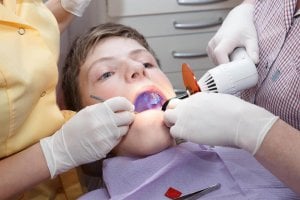 Sealing dental fissure procedure