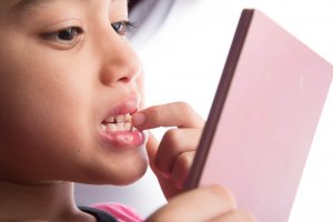 boy checking teeth for fluorosis