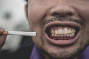 No smoking for 72 hours after tooth extraction