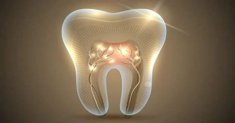 teeth translucent cracking