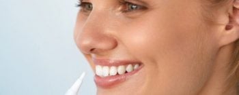 radiance teeth whitening