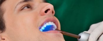 dental bonding