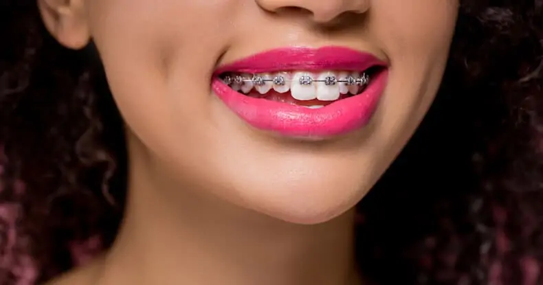 dental insurance for braces