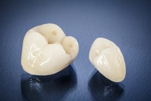 dental implant crown showing through gum