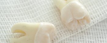 how long to keep gauze in after tooth extraction