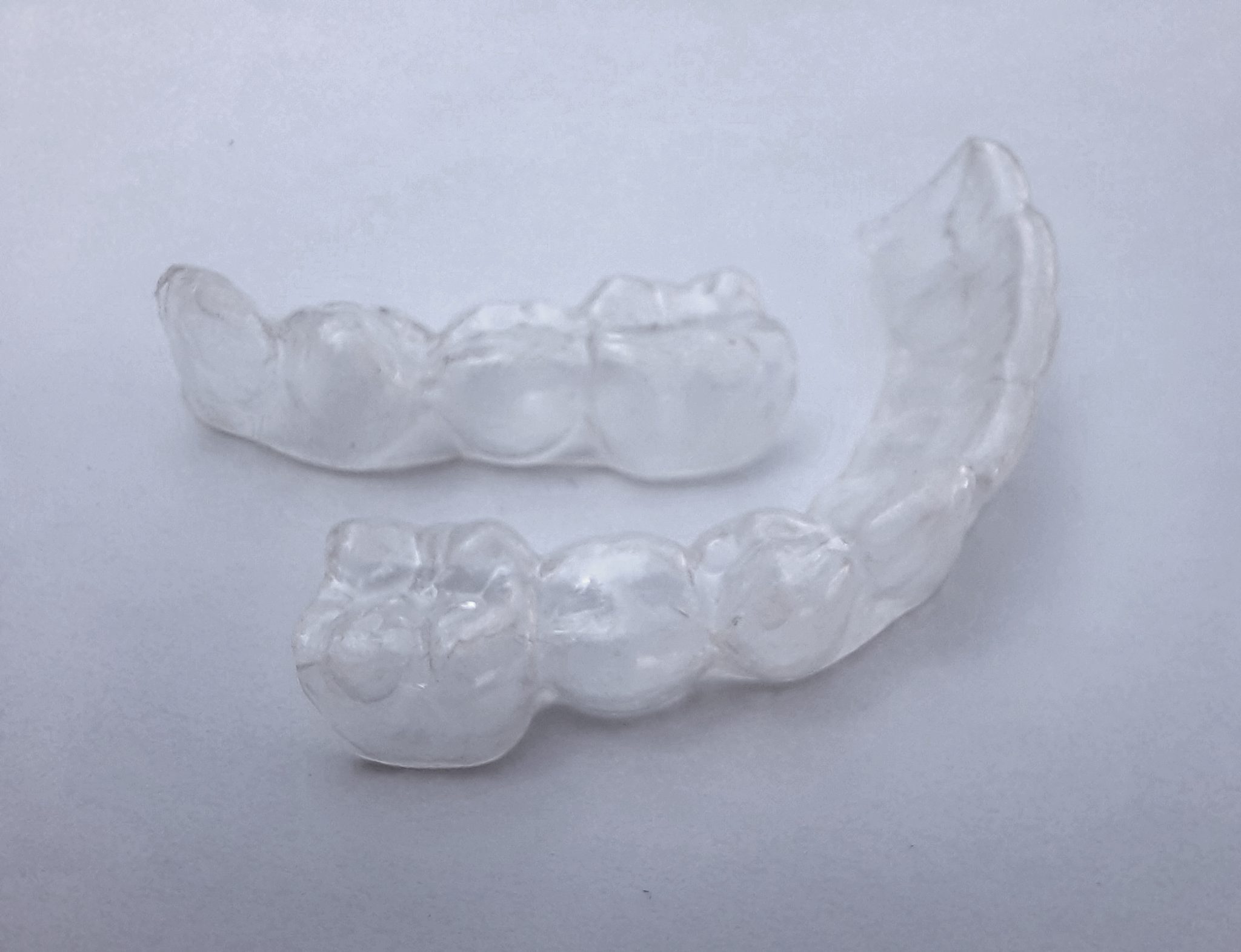 Retainer Replacement Do You Need It and What's the Cost?