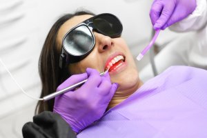 Gum reduction with lasers