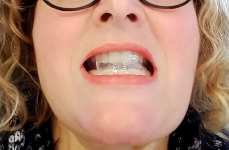 Zimba Whitening Strips Review Do They Actually Work?