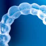 44693Lingual Braces vs Invisalign: Cost, Treatment, Pros, and Cons
