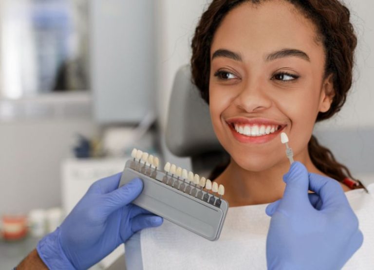 Dental Veneers Cost, Types, Materials, Uses, and Pros and Cons