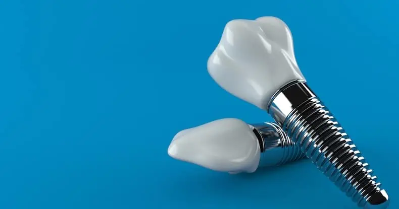 $399 dental implants