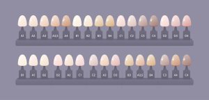 tooth shade chart