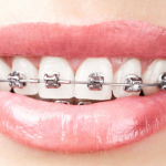 54268Best Dental Insurance in Indiana: Delta Dental, Anthem, Humana
