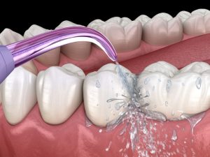 waterpik before or after brushing