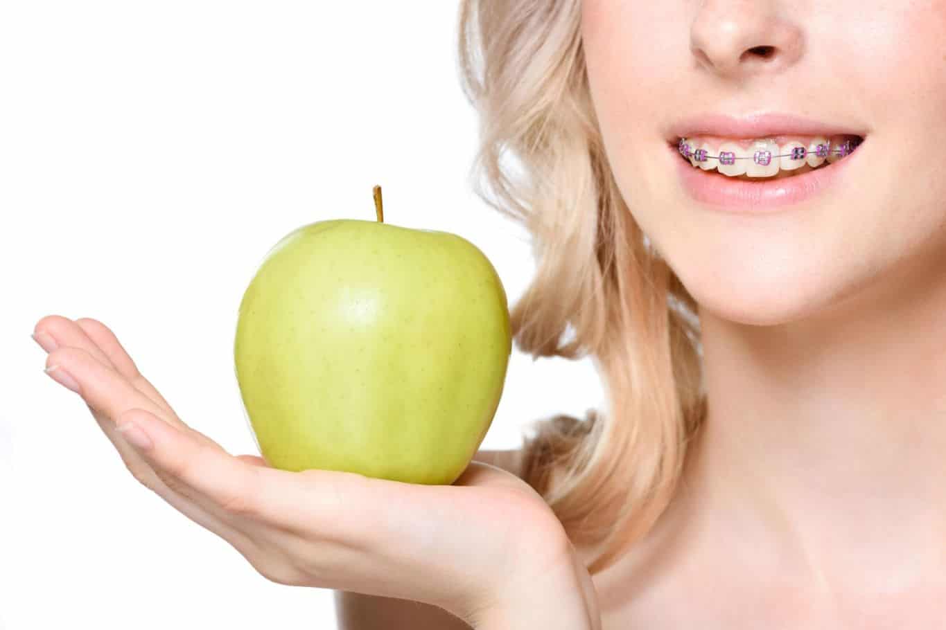 What Can You Eat with Braces the First Day? List of Top Meals & Snacks