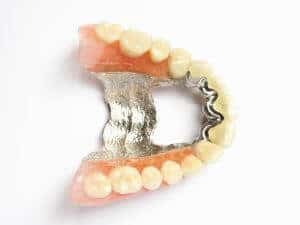 chrome dentures