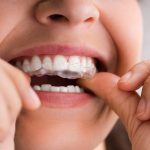 58198Does Green Tea Stain Your Teeth? 8 Tips How to Avoid Grey Stains