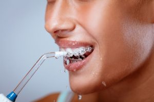 water flosser for braces