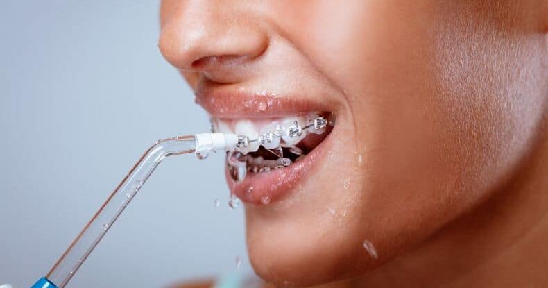 Close-up of a smiling person using a water flosser to clean teeth with braces, water spraying from the device.