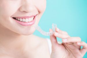 invisalign teeth whitening