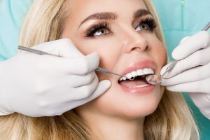are veneers covered by insurance