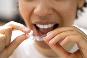does medicaid cover invisalign for adults